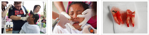 2011年「ハローアルソン」フィリピン医療ボランティア詳細